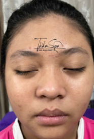 Khách hàng trải nghiệm dịch vụ Trị Mụn Sạm Đen