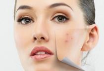 Thói Quen Tưởng Vô Hại Nhưng Đang Âm Thầm Tàn Phá Làn Da