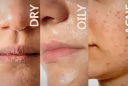 Da bạn thuộc loại nào? 90% người chăm sóc da đang nhầm ngay từ bước này