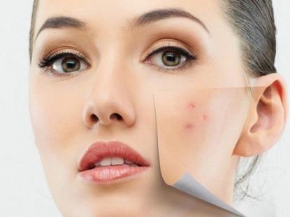 Thói Quen Tưởng Vô Hại Nhưng Đang Âm Thầm Tàn Phá Làn Da